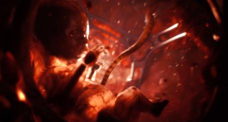 feto-utero