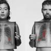 Campaña See through the symptoms, sobre la concienciación del cáncer de pulmón