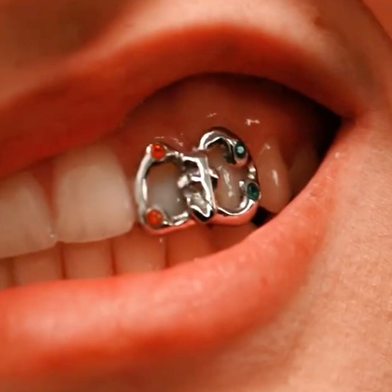 Una imagen de los grillz en los dientes de una chica y sobre unos bloques de hielo verdes