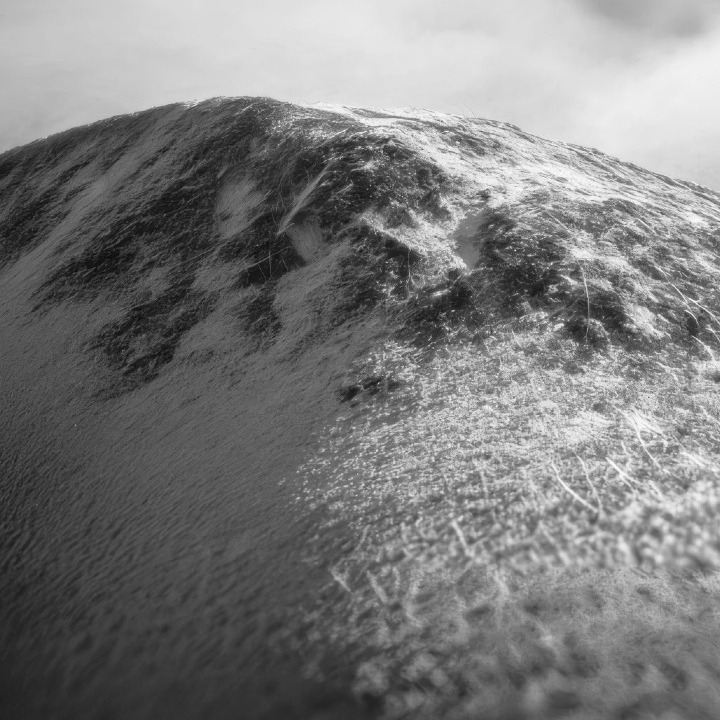 Un bulto de melanoma en blanco y negro que parece una montaña nevada