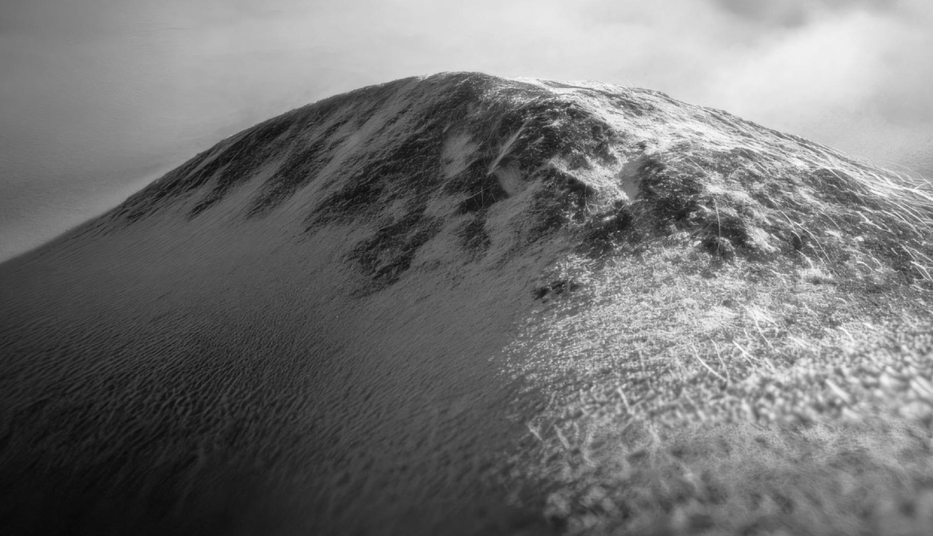 Un bulto de melanoma en blanco y negro que parece una montaña nevada