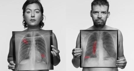 Campaña See through the symptoms, sobre la concienciación del cáncer de pulmón