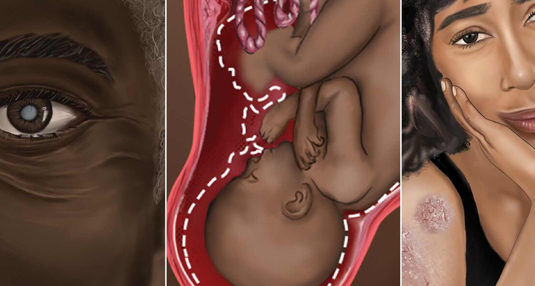 Jhonson & Johnson crea una colección de ilustraciones médicas para mejorar la representación en el sistema sanitario