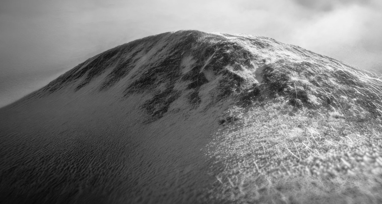 Un bulto de melanoma en blanco y negro que parece una montaña nevada