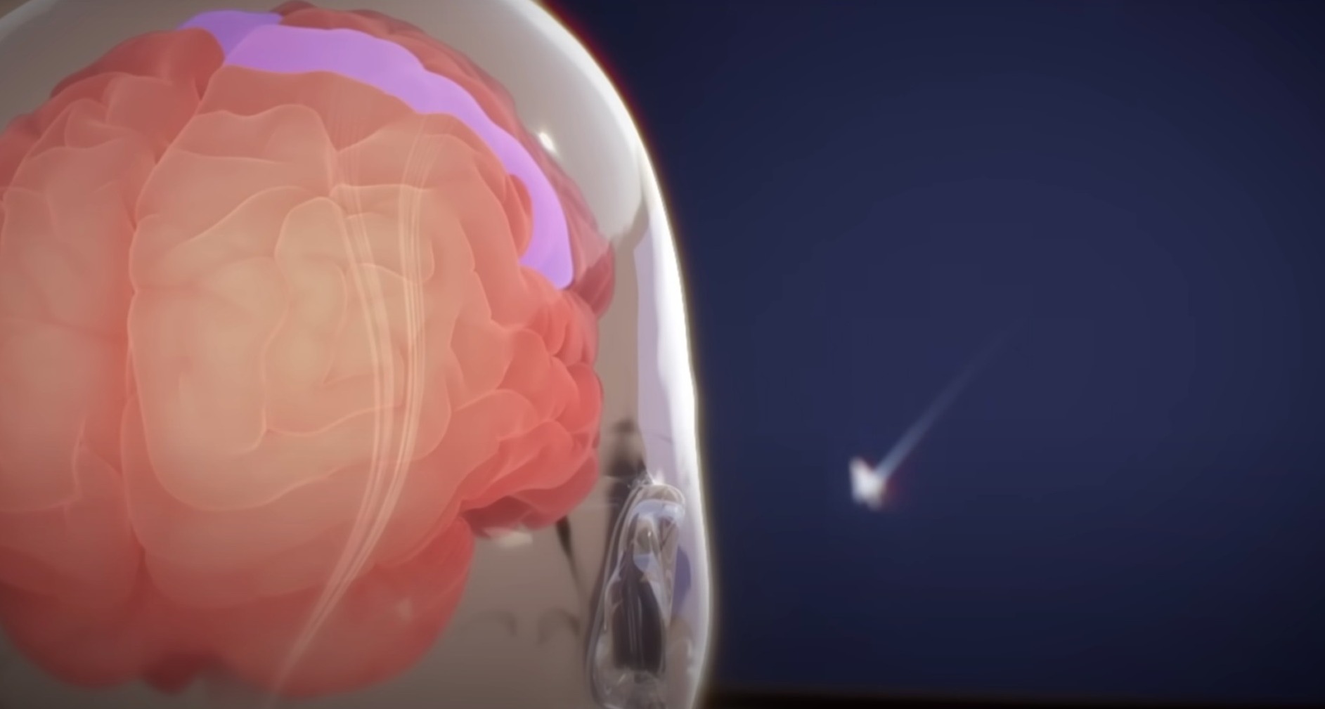 Un poderoso rival para Neuralink, la empresa de Elon Musk: China trabaja en el implante de chips en el cerebro Neuralink_implante cerebral
